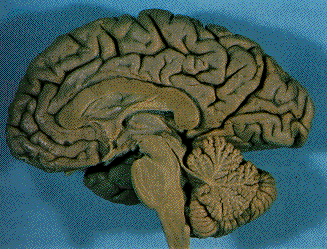 Right Half of The Brain: Midsagittal Section